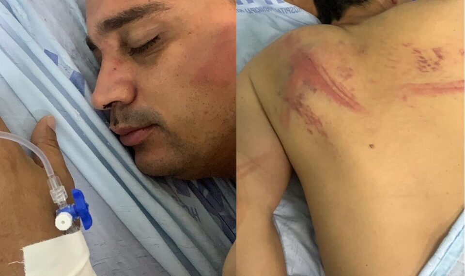 Ex-prefeito de Bom Jardim é sequestrado e brutalmente espancado